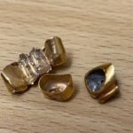 ブランド品＆金・プラチナ買取マートコムタウン岡崎店で買取した貴金属金歯 歯科金属 金合金